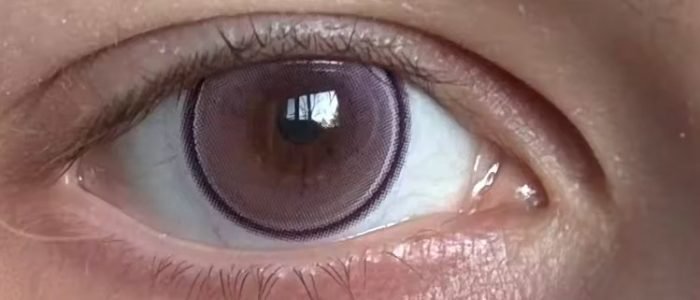 I recieve my lense today, they are so beautifull😍😍😍😍